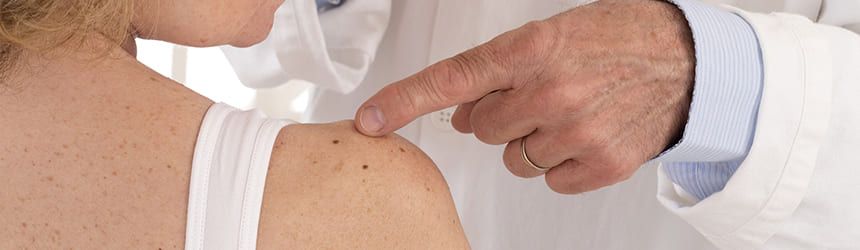 Clínica Dermatológica Zaidín tratamientos para la melanoma